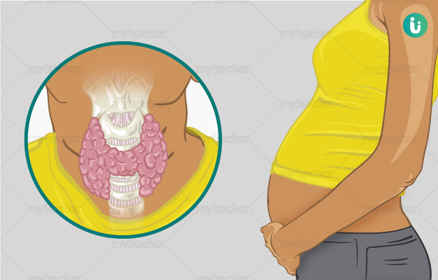 Download Thyroid K Symptoms In Hindi Background