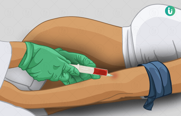 TORCH PANEL, IGG & IGM: Procedure, Purpose, Results, Cost, Price ...