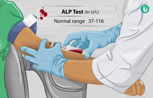 Alpi Lab Normal Ranges What Is Alp Blood Test – Alkaline phosphatase – ZYVMH