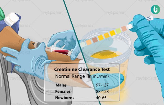 Normal Crea What Is A Blood Creatinine Test? – VIXG